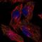 TBC1 Domain Family Member 31 antibody, NBP1-81818, Novus Biologicals, Immunofluorescence image 