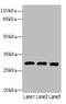 Chymotrypsin Like Elastase 3A antibody, A56968-100, Epigentek, Western Blot image 