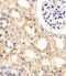 Ubiquitin Conjugating Enzyme E2 L3 antibody, LS-C157009, Lifespan Biosciences, Immunohistochemistry frozen image 