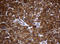 NME/NM23 Nucleoside Diphosphate Kinase 1 antibody, LS-C175622, Lifespan Biosciences, Immunohistochemistry paraffin image 