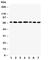 DEAD-Box Helicase 5 antibody, R31068, NSJ Bioreagents, Western Blot image 