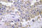 Laminin Subunit Beta 2 antibody, LS-C177176, Lifespan Biosciences, Immunohistochemistry frozen image 