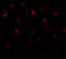 Proline Rich 5 Like antibody, A10603, Boster Biological Technology, Immunofluorescence image 