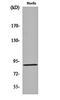 Leucine Rich Repeat Containing G Protein-Coupled Receptor 6 antibody, orb161614, Biorbyt, Western Blot image 