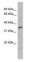 Myogenic factor 5 antibody, PA1-24450, Invitrogen Antibodies, Western Blot image 