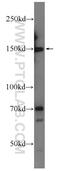 ATPase Family AAA Domain Containing 5 antibody, 24954-1-AP, Proteintech Group, Western Blot image 