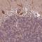 Casein Kinase 1 Gamma 2 antibody, NBP2-49232, Novus Biologicals, Immunohistochemistry paraffin image 