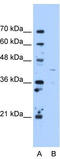 Ornithine Aminotransferase antibody, TA346530, Origene, Western Blot image 