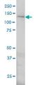 Endoplasmic Reticulum To Nucleus Signaling 1 antibody, H00002081-M02, Novus Biologicals, Western Blot image 