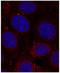 Insulin Like Growth Factor 1 Receptor antibody, STJ22185, St John