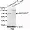 Arachidonate 5-Lipoxygenase antibody, AP0573, ABclonal Technology, Western Blot image 