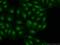 Mitotic spindle assembly checkpoint protein MAD1 antibody, 18322-1-AP, Proteintech Group, Immunofluorescence image 