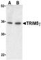 Tripartite motif-containing protein 5 antibody, LS-B3198, Lifespan Biosciences, Western Blot image 