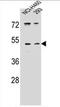 Serine Protease 55 antibody, AP54471PU-N, Origene, Western Blot image 