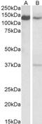 Toll Like Receptor Adaptor Molecule 1 antibody, 43-669, ProSci, Western Blot image 