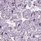 Growth Arrest Specific 2 Like 2 antibody, NBP2-32029, Novus Biologicals, Immunohistochemistry paraffin image 