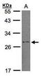 Regulator Of G Protein Signaling 2 antibody, PA5-28162, Invitrogen Antibodies, Western Blot image 