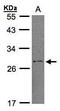 Regulator of G-protein signaling 2 antibody, PA5-28162, Invitrogen Antibodies, Western Blot image 