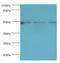 Decapping MRNA 2 antibody, LS-C378036, Lifespan Biosciences, Western Blot image 