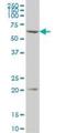 ANTXR Cell Adhesion Molecule 2 antibody, H00118429-B01P, Novus Biologicals, Western Blot image 