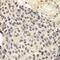 Karyopherin Subunit Alpha 1 antibody, GTX54302, GeneTex, Immunohistochemistry paraffin image 