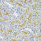 Ubiquitin Conjugating Enzyme E2 B antibody, 22-124, ProSci, Immunohistochemistry frozen image 