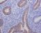 Anterior Gradient 2, Protein Disulphide Isomerase Family Member antibody, M02922, Boster Biological Technology, Immunohistochemistry paraffin image 