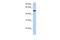 Polypeptide N-Acetylgalactosaminyltransferase 13 antibody, A09097, Boster Biological Technology, Western Blot image 