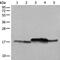 NADH:Ubiquinone Oxidoreductase Subunit B11 antibody, PA5-68425, Invitrogen Antibodies, Western Blot image 