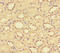 C-C Motif Chemokine Ligand 14 antibody, LS-C318606, Lifespan Biosciences, Immunohistochemistry paraffin image 