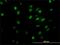 General Transcription Factor IIi antibody, H00002969-M02, Novus Biologicals, Immunocytochemistry image 