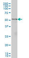 Glutamic--Pyruvic Transaminase antibody, LS-C197343, Lifespan Biosciences, Western Blot image 