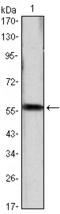 Cyclin D1 antibody, STJ97978, St John