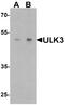 Unc-51 Like Kinase 3 antibody, A07706, Boster Biological Technology, Western Blot image 