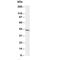 NPHS2 Stomatin Family Member, Podocin antibody, R30382, NSJ Bioreagents, Western Blot image 