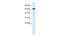 Tripartite Motif Containing 9 antibody, 28-206, ProSci, Western Blot image 