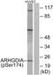 Rho GDP Dissociation Inhibitor Alpha antibody, PA5-38827, Invitrogen Antibodies, Western Blot image 