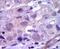 Ret Proto-Oncogene antibody, PA5-14722, Invitrogen Antibodies, Immunohistochemistry paraffin image 