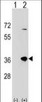 Sulfotransferase Family 1B Member 1 antibody, LS-C161607, Lifespan Biosciences, Western Blot image 