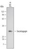 Secretagogin, EF-Hand Calcium Binding Protein antibody, PA5-47664, Invitrogen Antibodies, Western Blot image 
