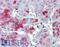 Perilipin 3 antibody, LS-B2539, Lifespan Biosciences, Immunohistochemistry paraffin image 