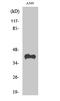 Rhodopsin antibody, STJ95451, St John