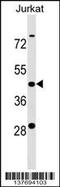 Potassium Channel Tetramerization Domain Containing 9 antibody, 59-337, ProSci, Western Blot image 