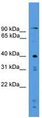 Serine Protease 23 antibody, TA340155, Origene, Western Blot image 