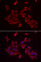 Retinoic Acid Receptor Responder 2 antibody, 22-590, ProSci, Immunofluorescence image 