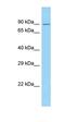 Calpain 10 antibody, orb330686, Biorbyt, Western Blot image 