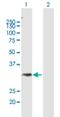 Acyl-CoA Wax Alcohol Acyltransferase 1 antibody, H00158833-B01P, Novus Biologicals, Western Blot image 