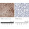 S100 Calcium Binding Protein B antibody, AMAb91038, Atlas Antibodies, Immunohistochemistry paraffin image 