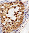 Aldehyde Dehydrogenase 9 Family Member A1 antibody, orb331054, Biorbyt, Immunohistochemistry paraffin image 