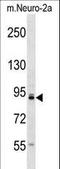 Tousled Like Kinase 1 antibody, LS-C158278, Lifespan Biosciences, Western Blot image 